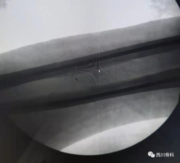 复杂问题简单化，能微创不切开